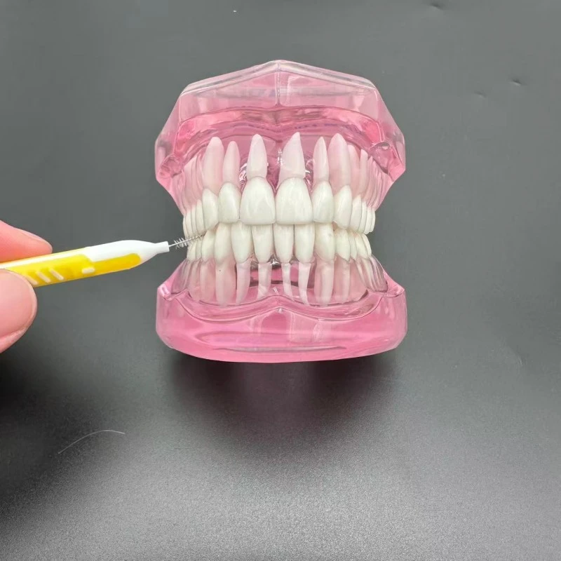 Overmolded Type I Interdental Brush Overmolded Type I Interdental Brush